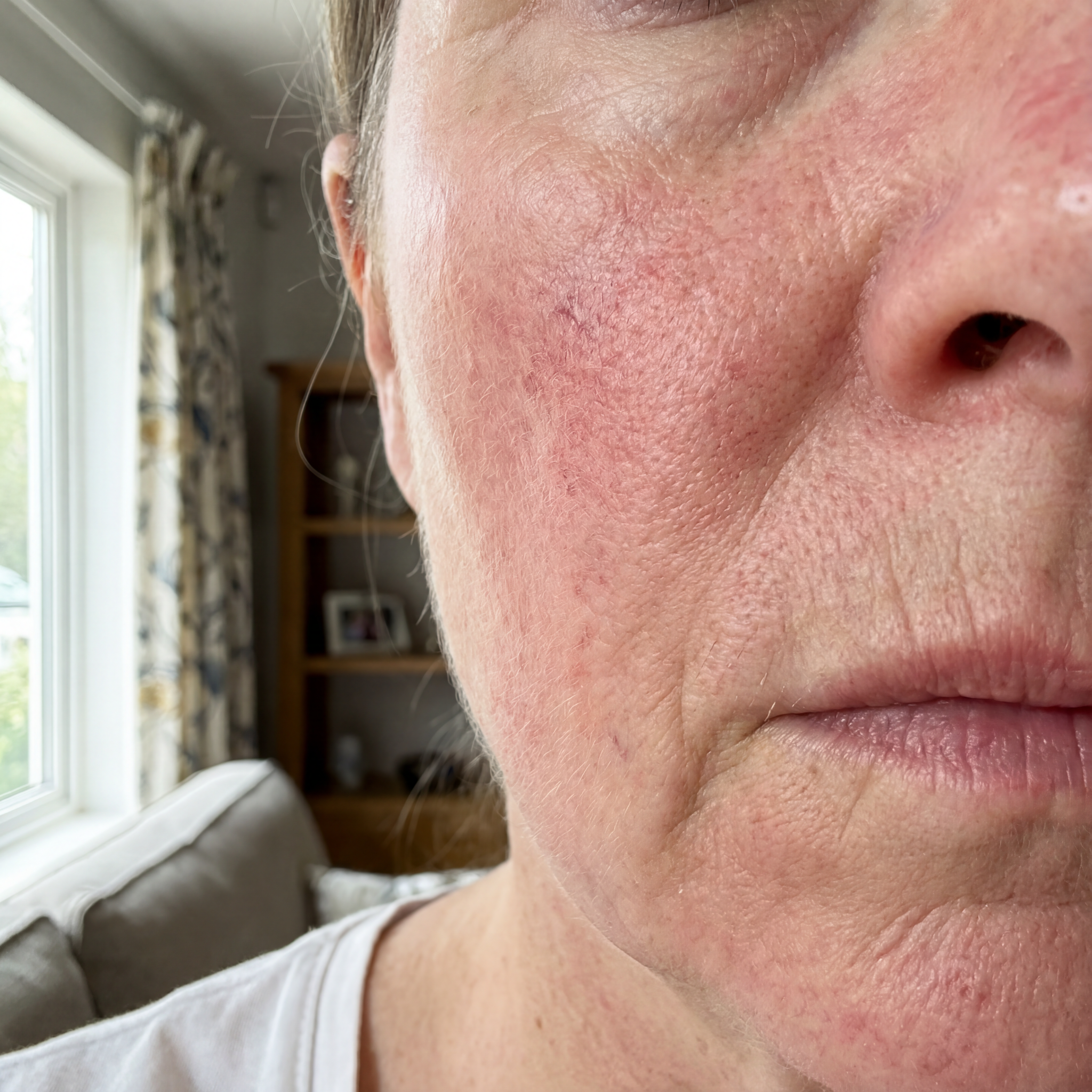 Melya Facebook ad: Mon dermatologue m'a dit que mes rougeurs étaient juste…