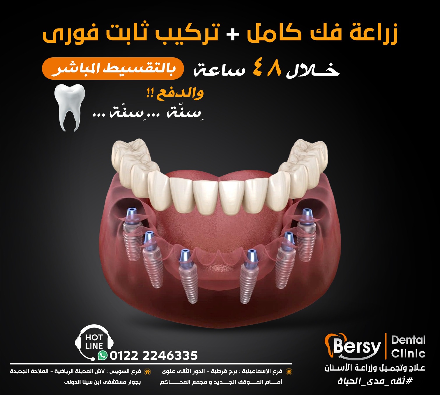 Bersy Dental Clinic Facebook ad: زراعة الأسنان بالتقسيط المباشر