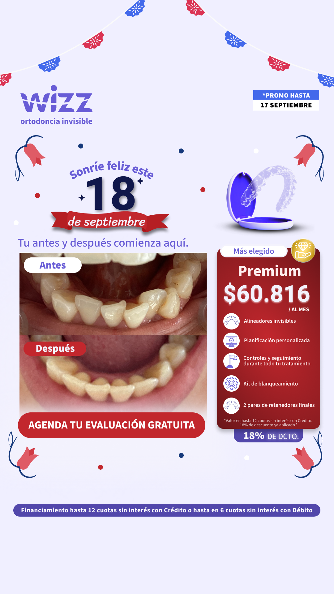 Wizz Chile Facebook ad: Alineadores en cuotas | 6 cuotas *Sin tarjeta de crédito*