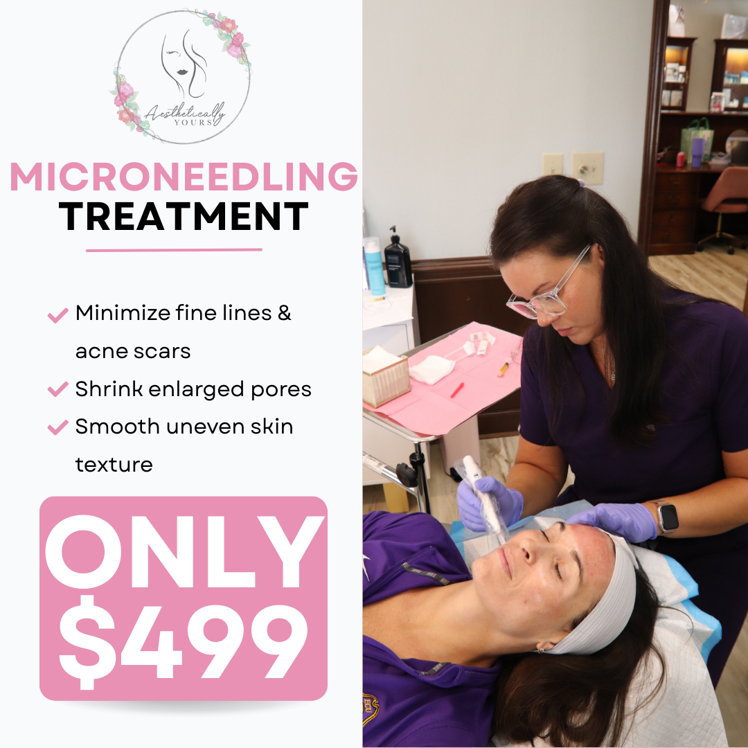 Aesthetically Yours Facebook ad: $499 PRP Microneedling Treatment!