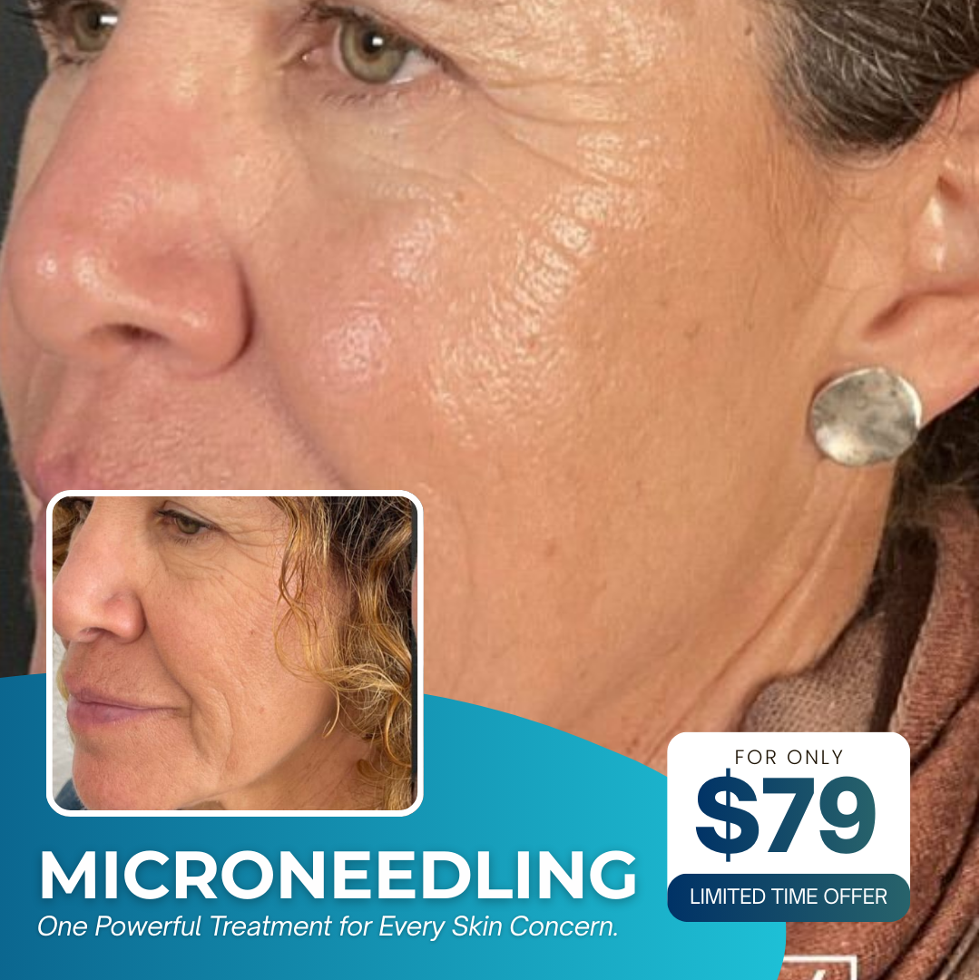 I Love Skin Treatments Facebook ad