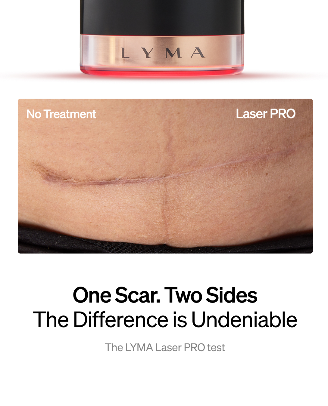 LYMA Facebook ad