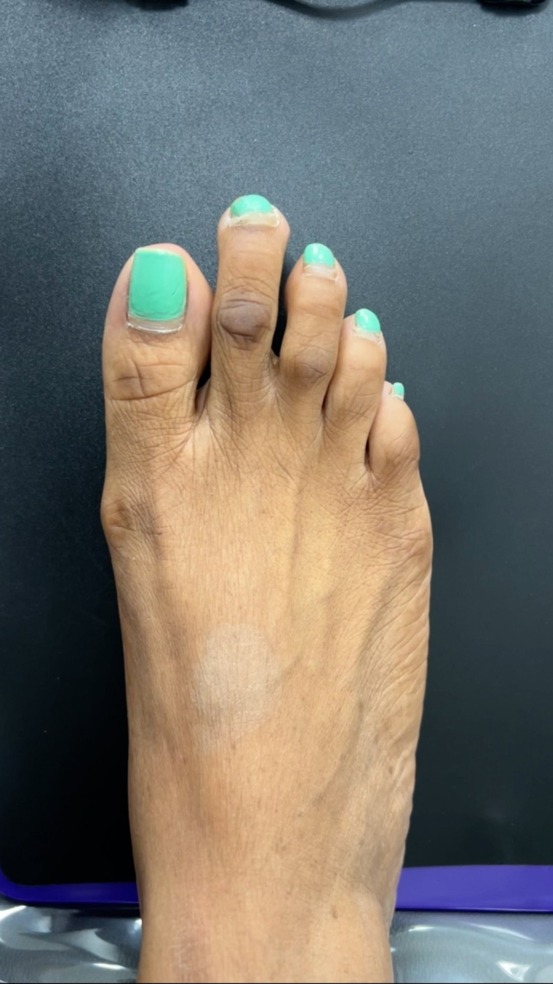 Foot First Podiatry Centers Facebook ad: Just a lil update