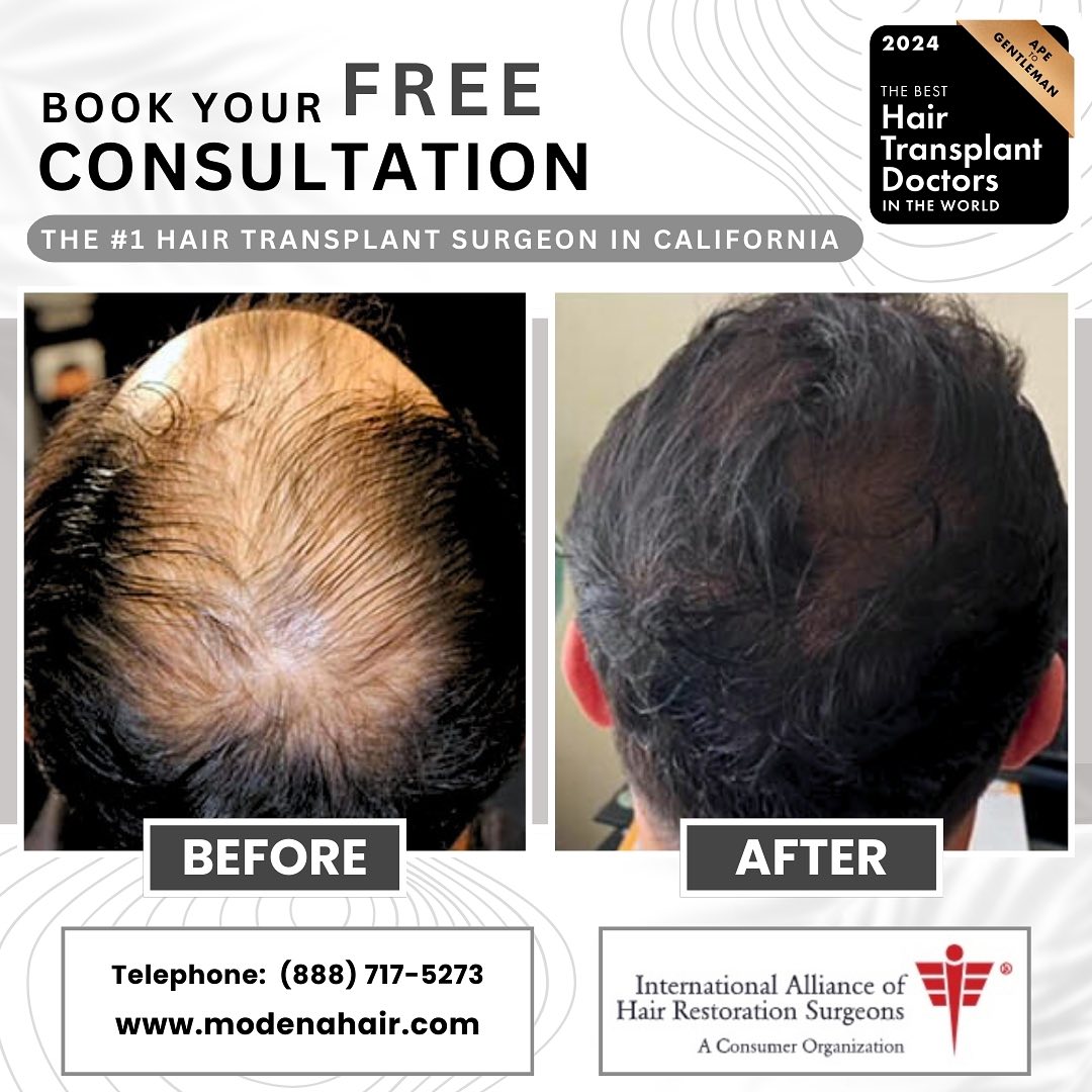 Modena Hair Institute Facebook ad