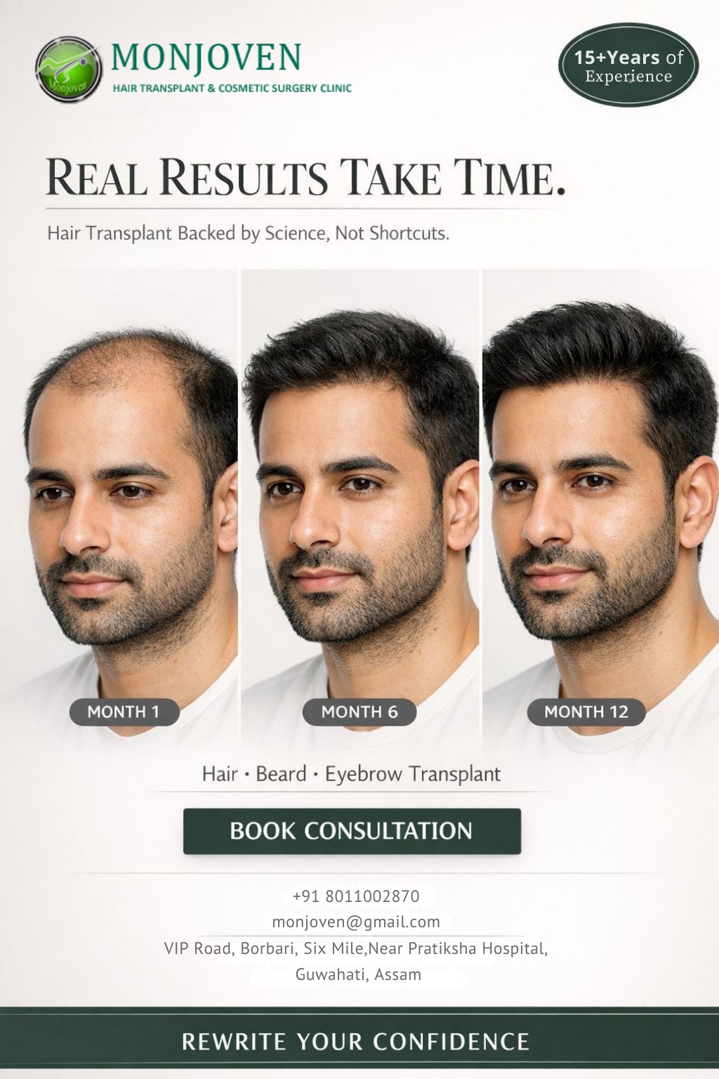 Monjoven Hair Transplant & Cosmetic Surgery Clinic Facebook ad: Turn Your Hair Loss Anxiety Into Absolute Confidence.