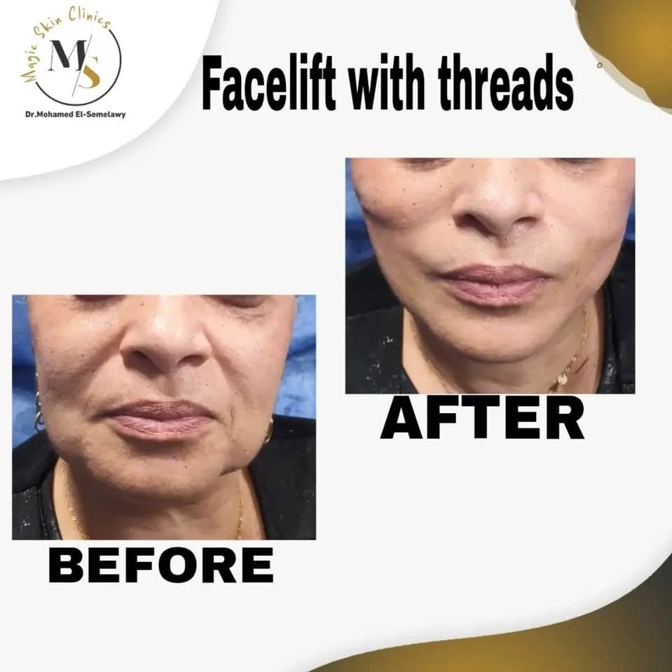 Magic skin clinics Facebook ad