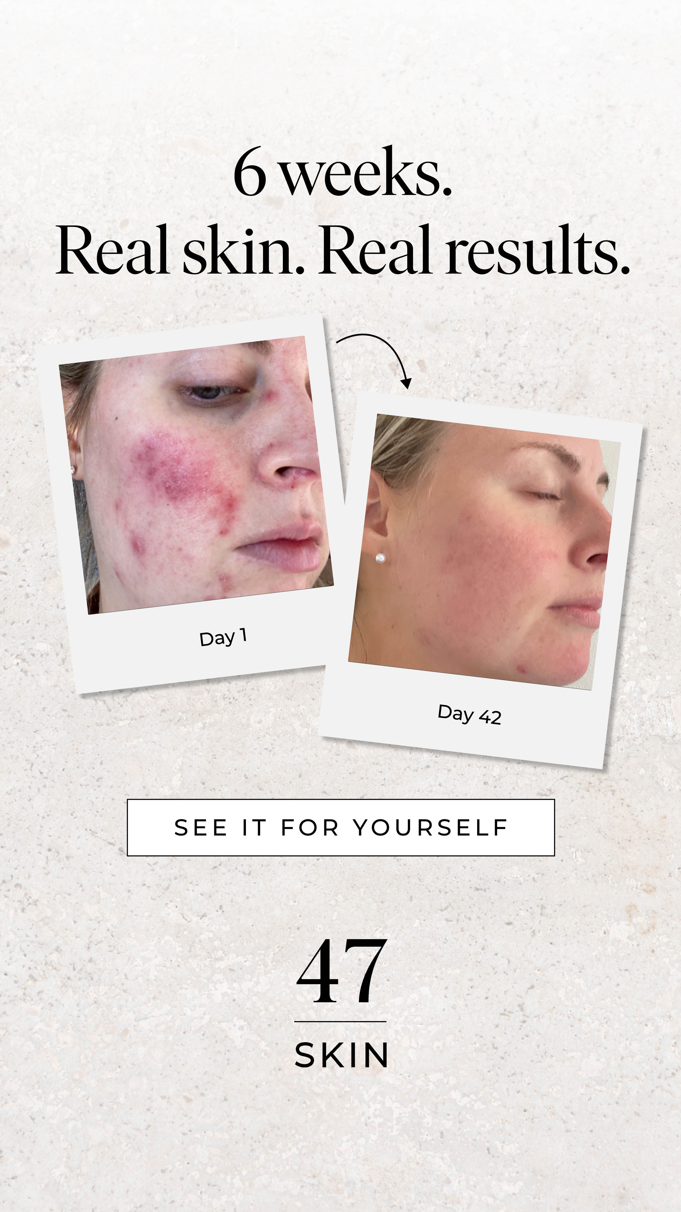 47Skin Facebook ad