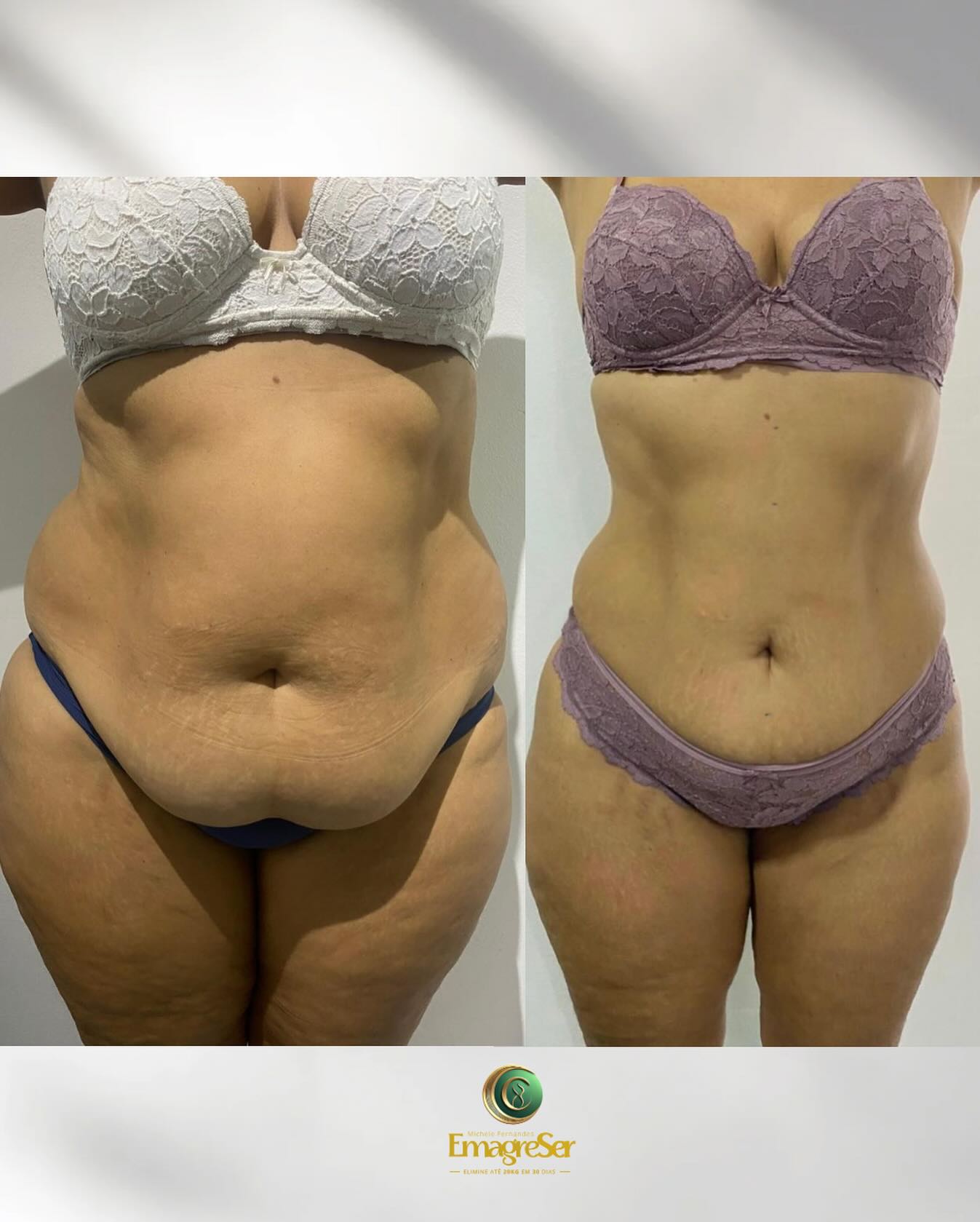 Michele Ozônio Terapia Facebook ad: Resultado REAL em apenas 60 dias!