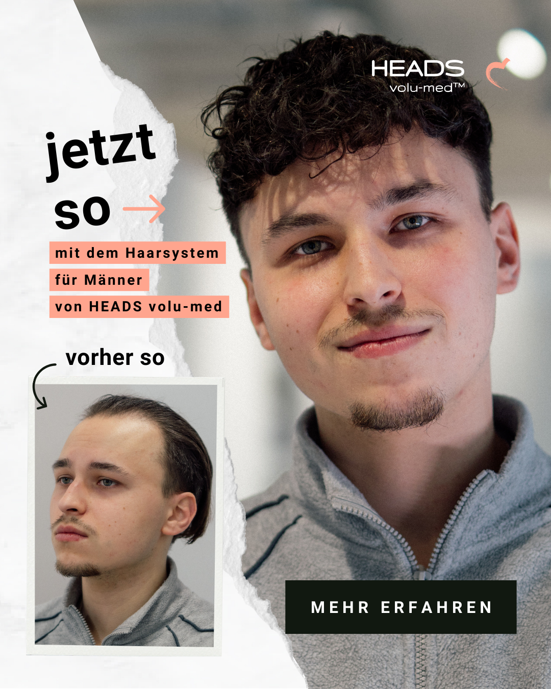 HEADS volu-med Facebook ad