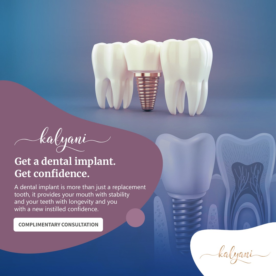 Kalyani Dental Lounge Facebook ad from Dec 30, 2025
