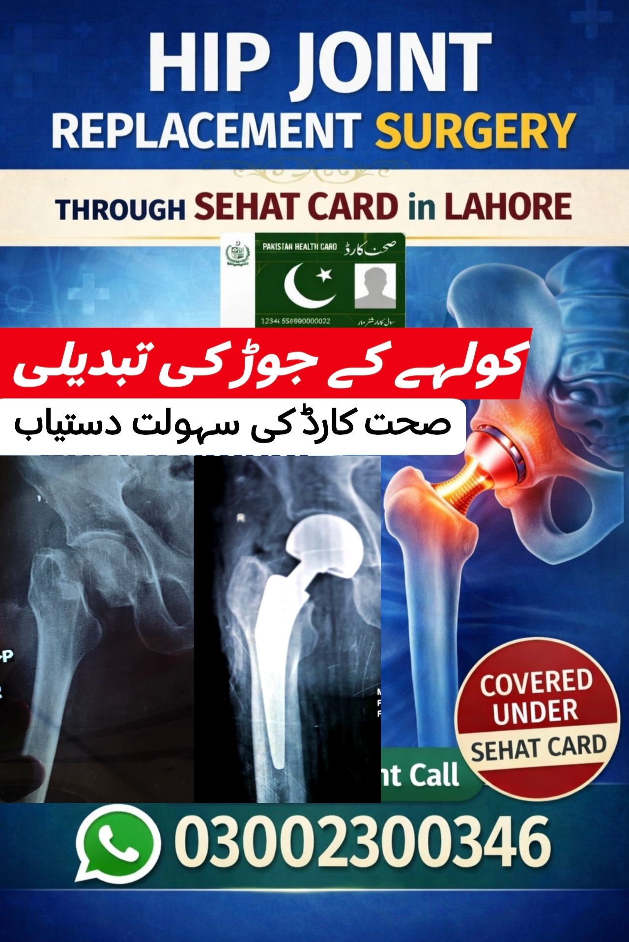 OSC-Orthopedic Surgery Center Facebook ad: کولہے کے جوڑ کی تبدیلی