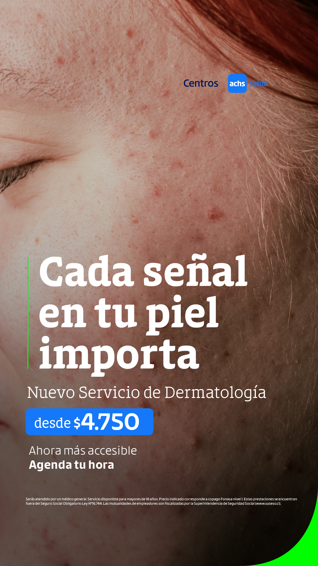 Achs Salud Facebook ad: Agenda tu evaluación dermatológica en Achs Salud