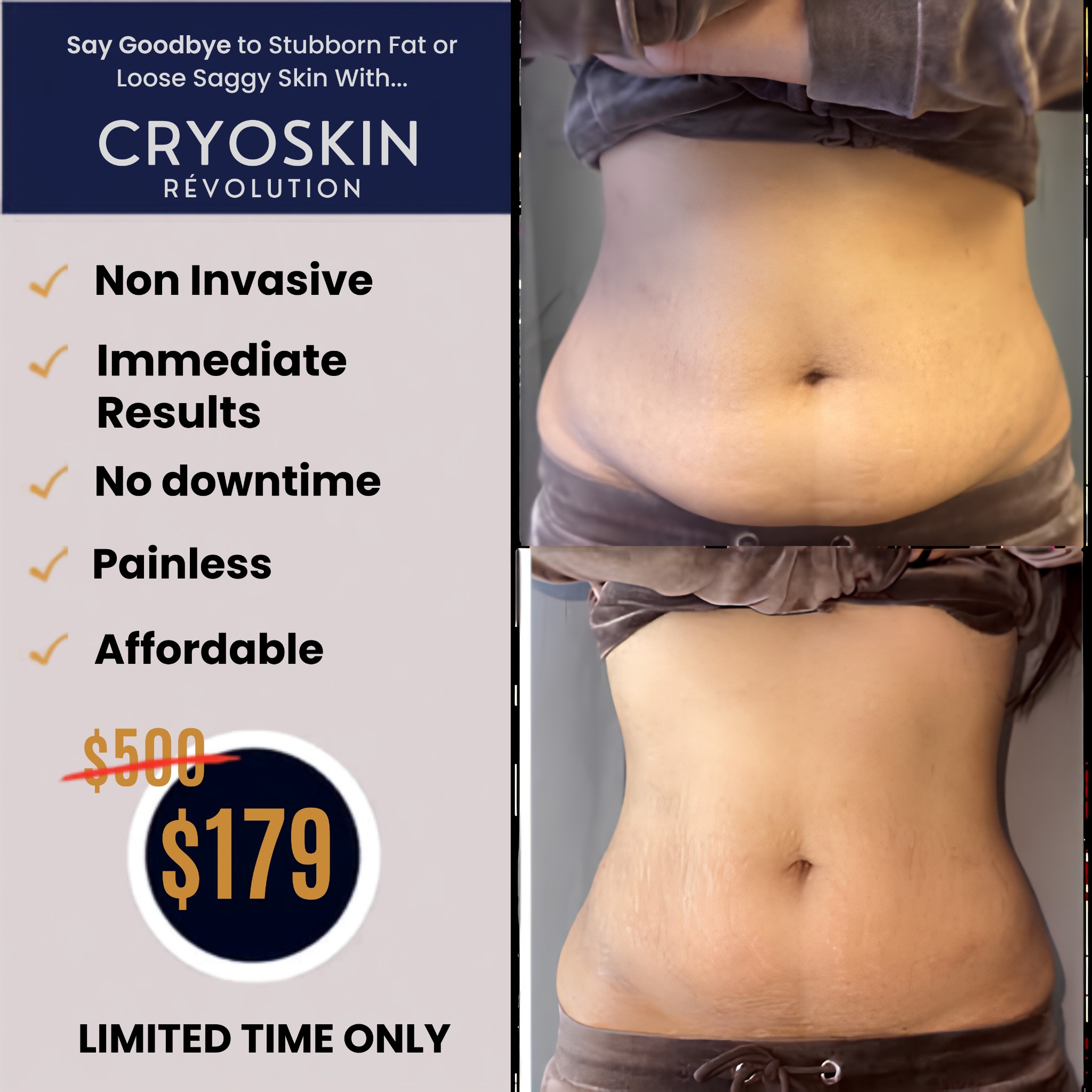 US Cryotherapy - Roseville, CA Facebook ad: Time To Fix Your Loose Skin