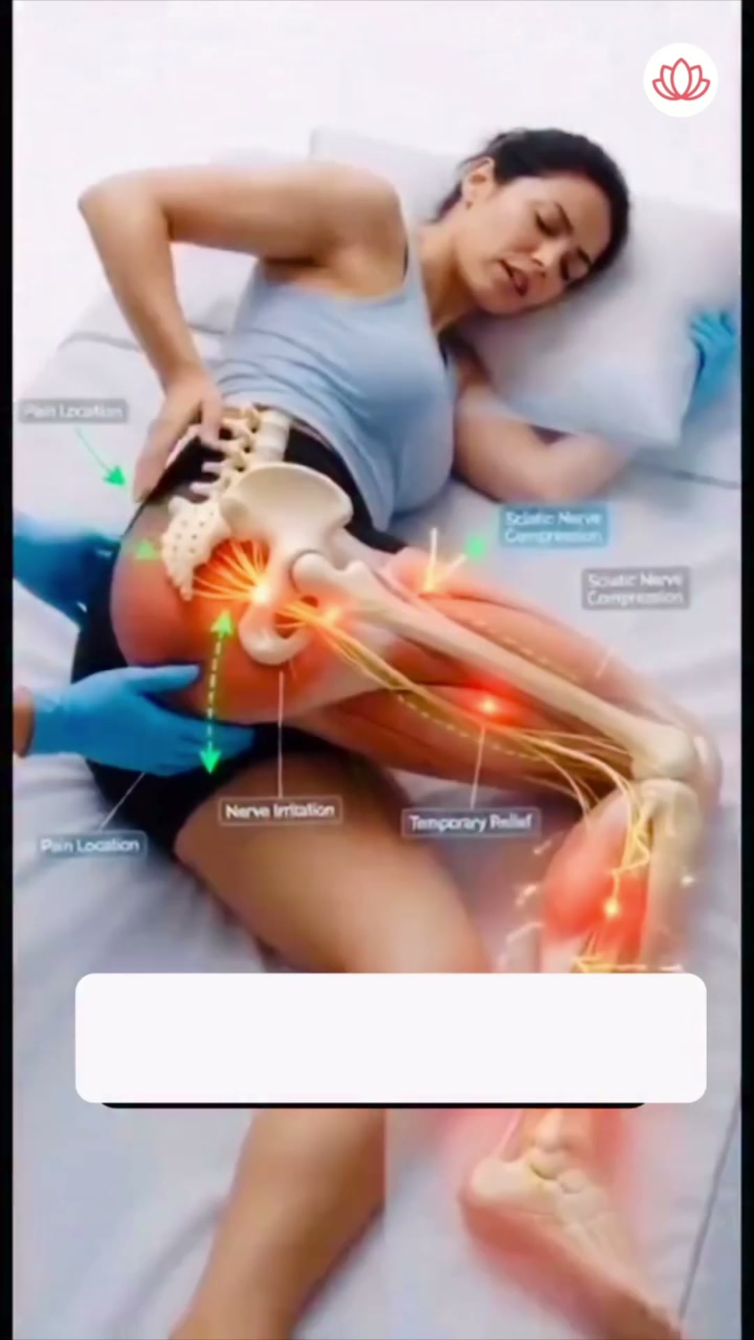 Zanskar: Muscle & Joint Relief Facebook ad: 6X Deeper Relief for Sciatica Pain