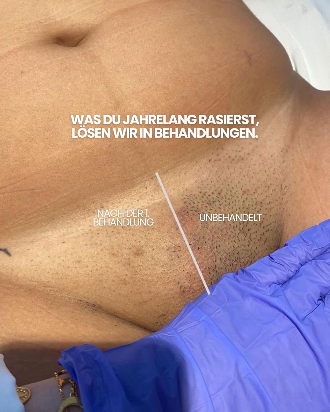 laserandskin.ch Facebook ad from May 20, 2026