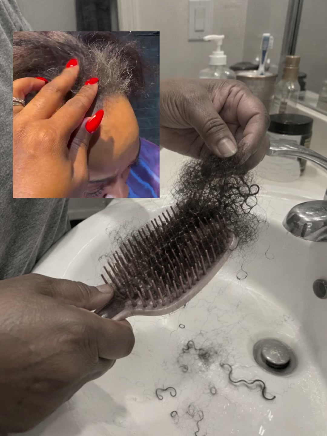 OrréNaturals Facebook ad: From Spreading Bald Spot… to Stopping It Cold.