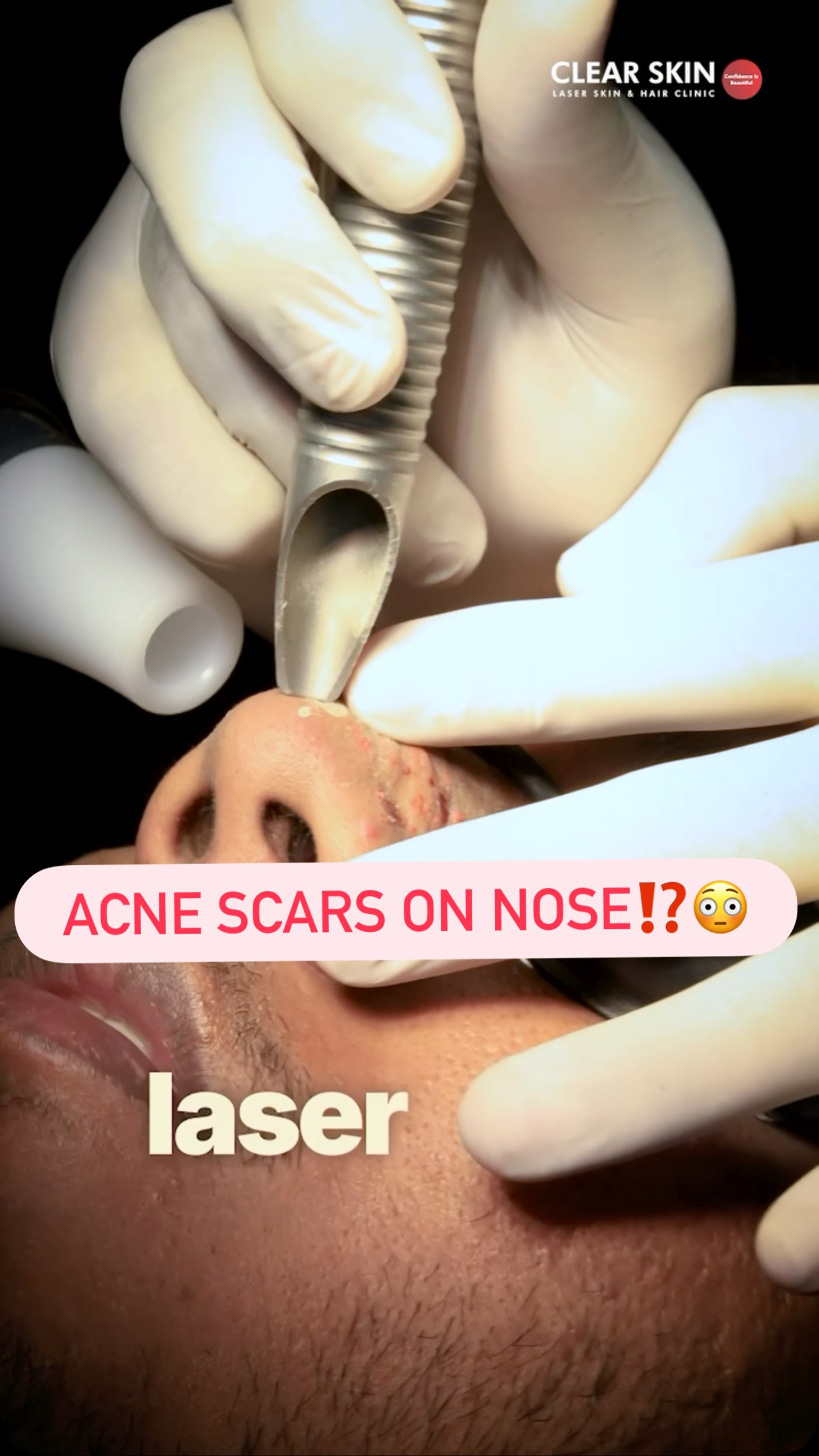 Clear Skin - Skin Clinic Facebook ad: Chat with us