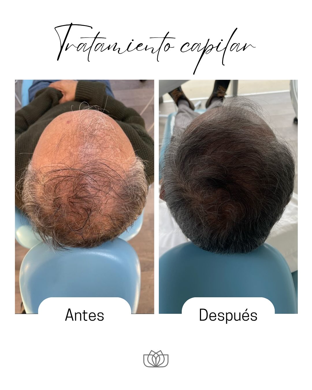 LOTUS Clinica Dental Facebook ad: Recupera la fuerza y vitalidad de tu cabello…