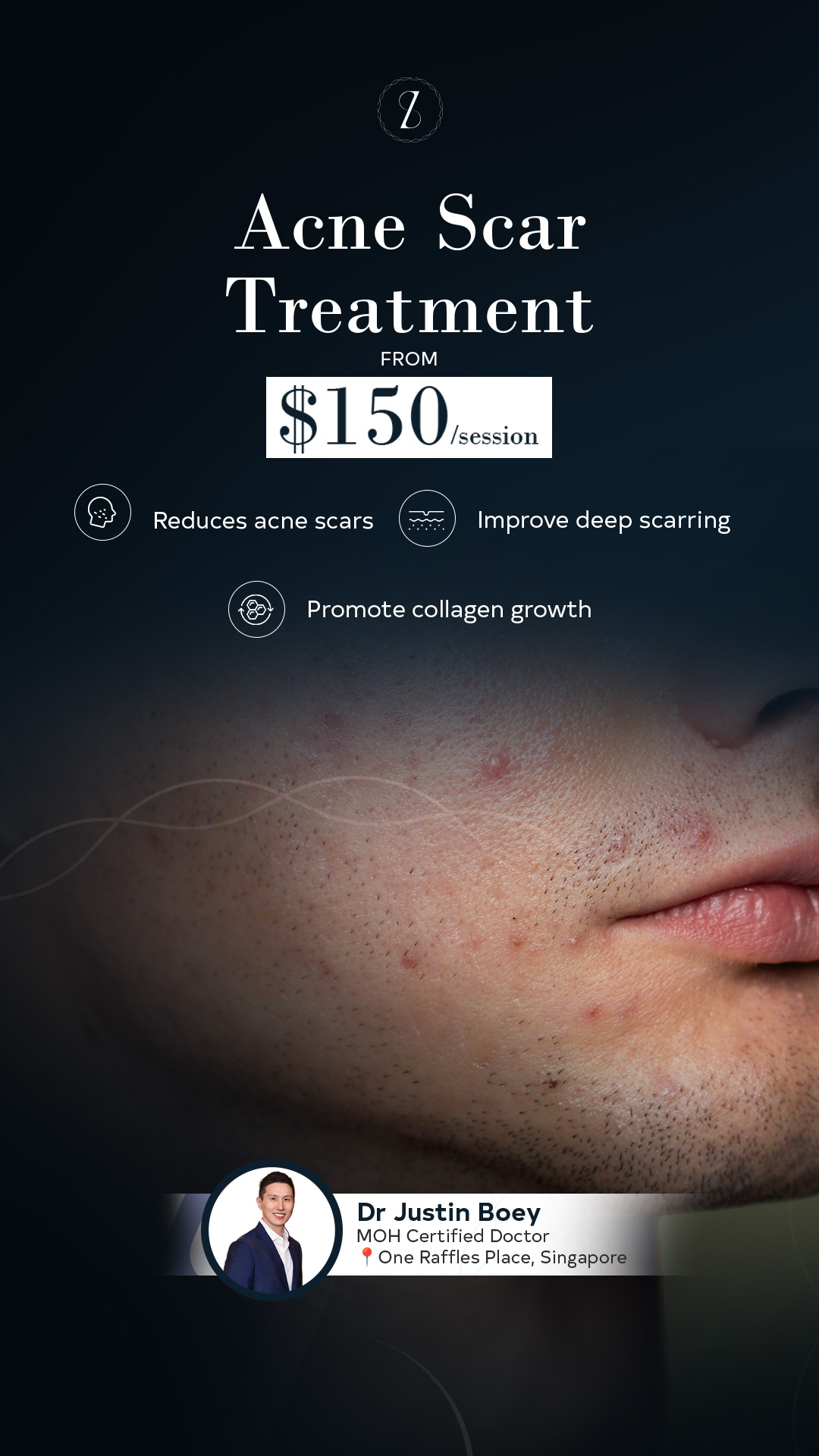 Sozo Aesthetic Clinic Facebook ad: Acne Scar Treatment From $150/session