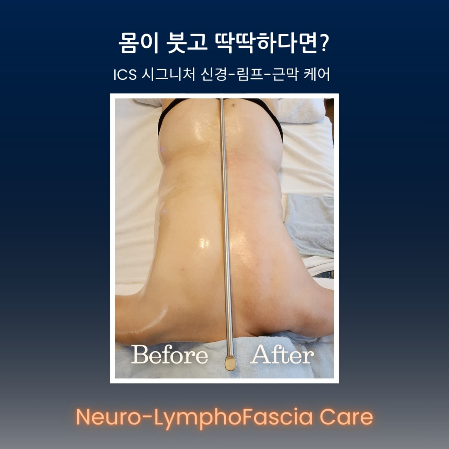 maison_de.sante Facebook ad: 살 찐 게 아니고, 부은 거였어?