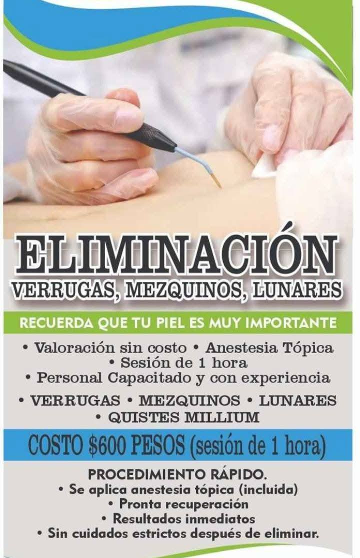 mirror Cosmetología y terapia física Facebook ad: ELIMINACIÓN DE VERRUGAS