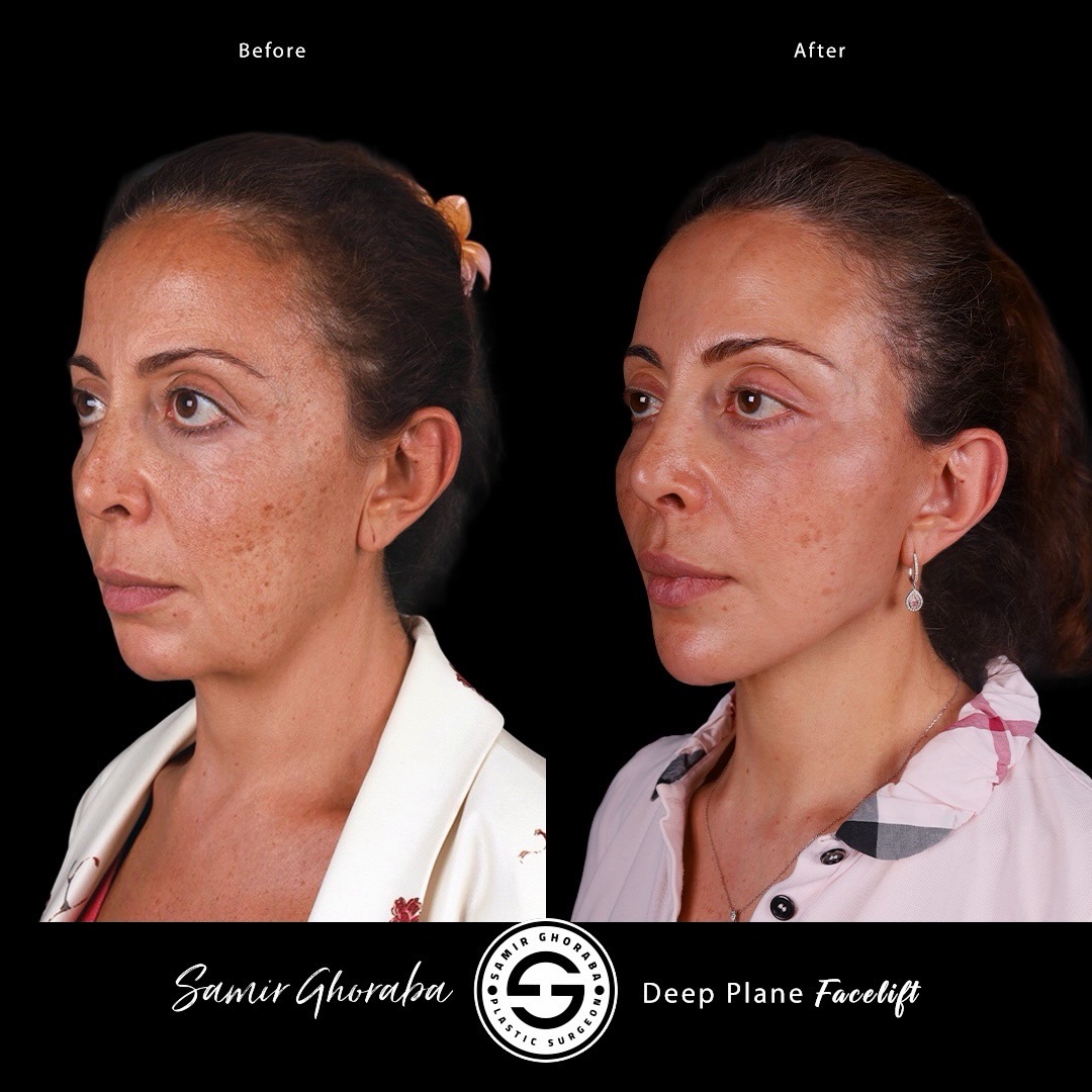 Dr samir Ghoraba Facebook ad: 6 Months Update