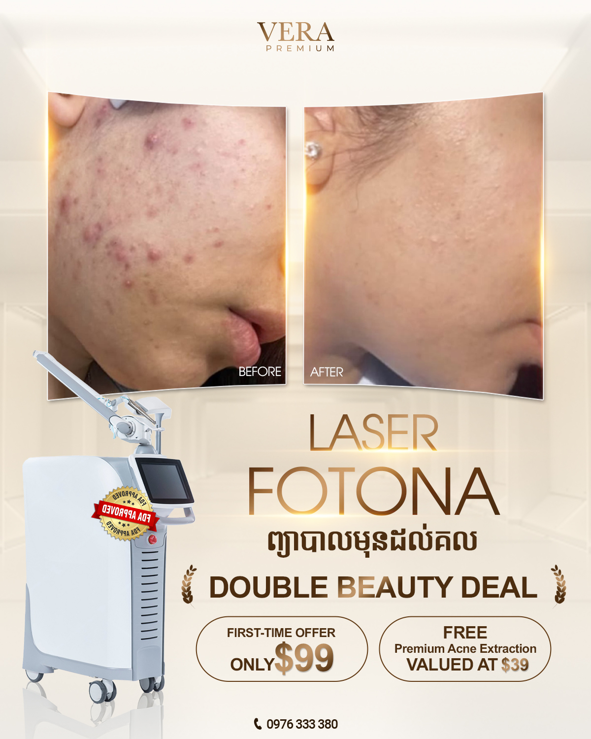 Vera Premium - Vera ព្រីមៀម Facebook ad: (English below) ទទួលបានបទពិសោធន៍ព្យាបាលមុនដោយ LASER FOTONA…