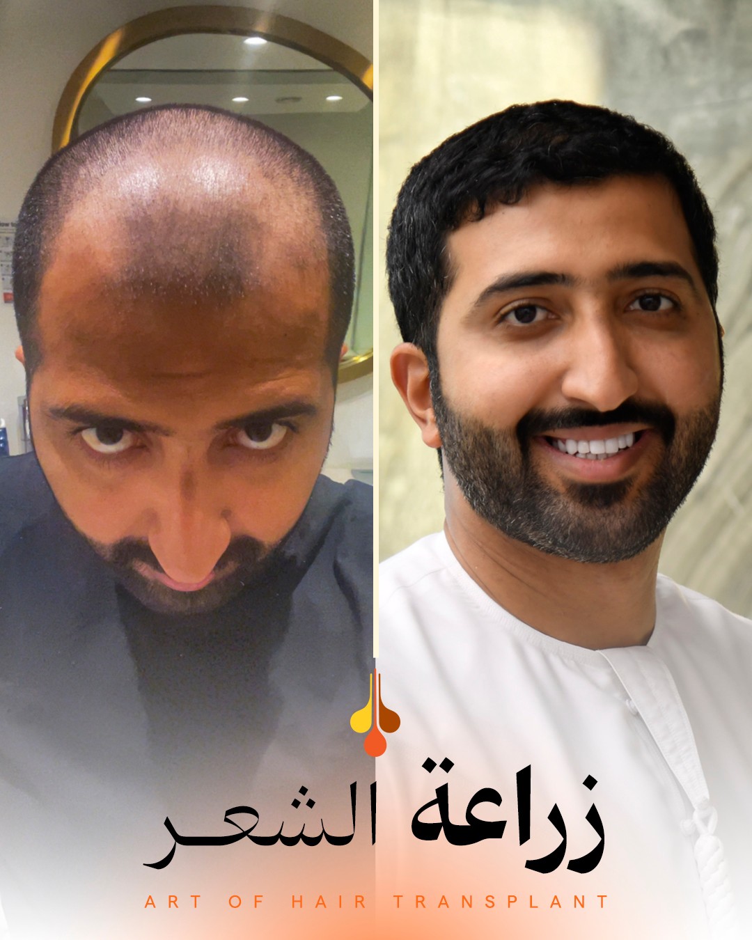 Padra Clinic Qatar Facebook ad