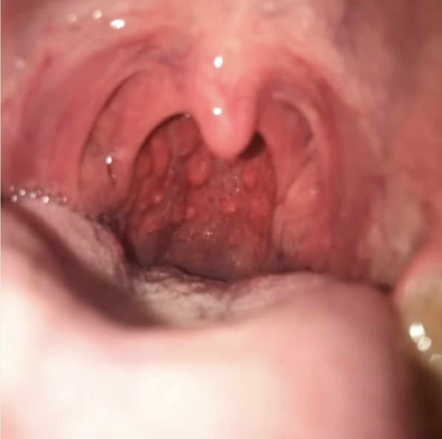 Dr. Sofia Nilsson Facebook ad from Jul 27, 2026