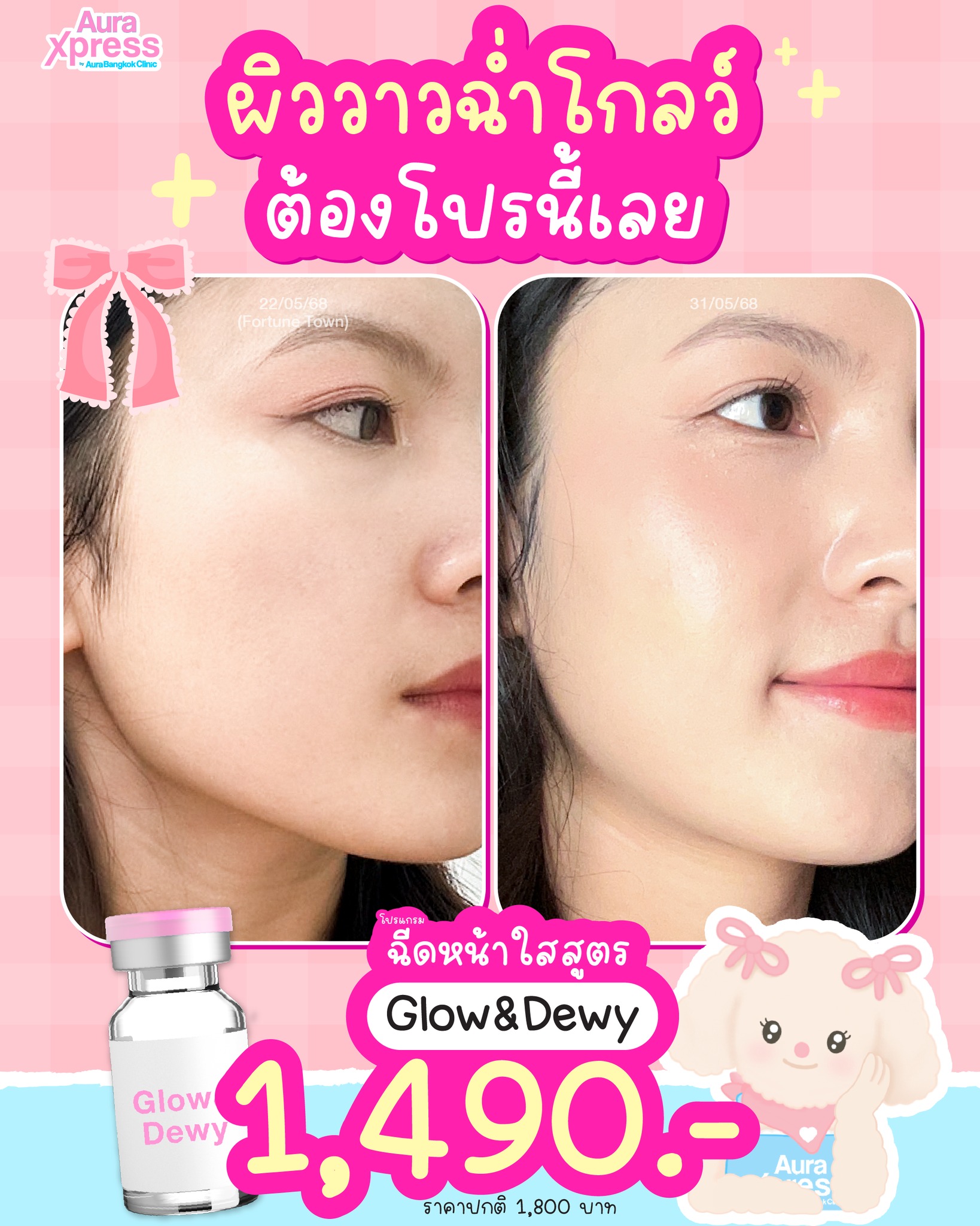 Aura Xpress by Aura Bangkok Clinic Facebook ad