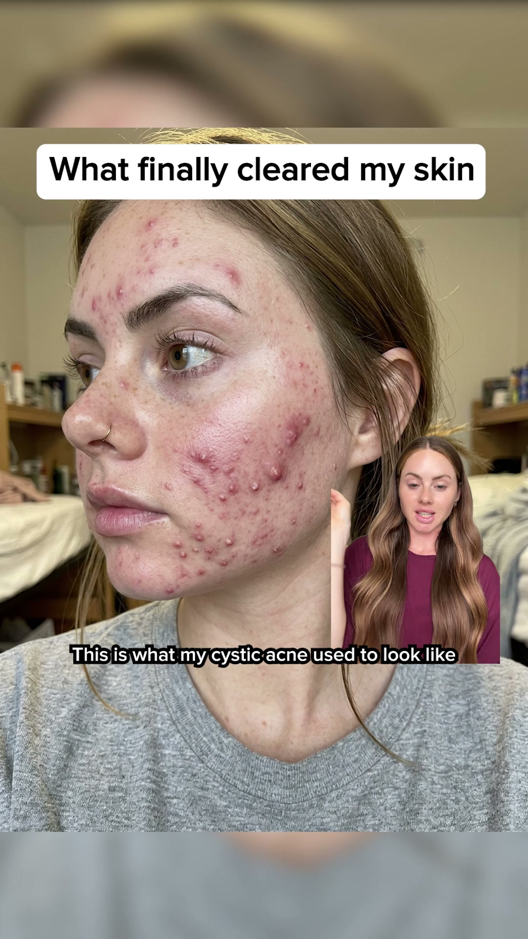 Based Supplies Facebook ad: Restore Your Skin in 3 Weeks!