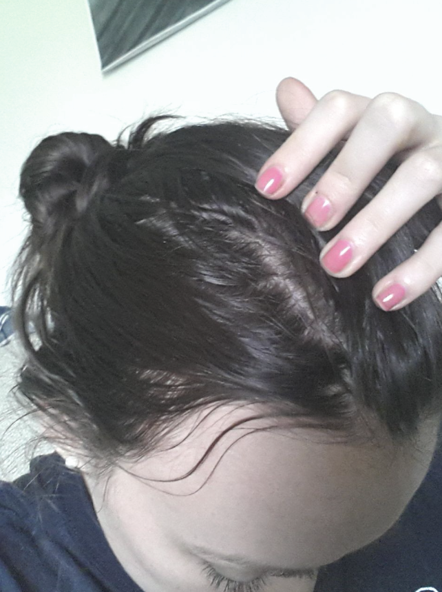 Laura Bennett Facebook ad: Fix Your GLP-1 Hair Loss Today
