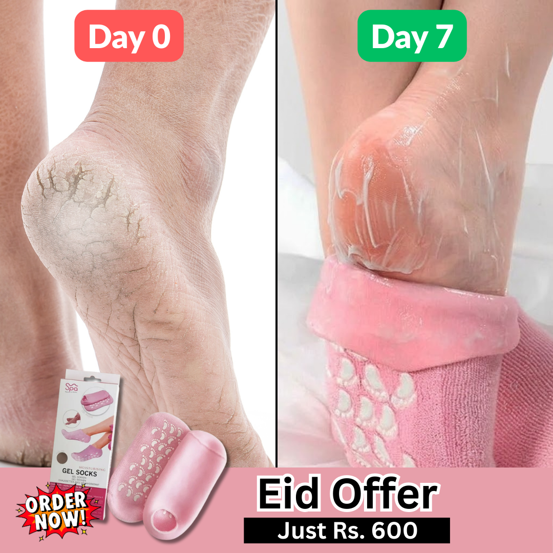 A Mart Facebook ad: Say Goodbye to Cracked Heels!