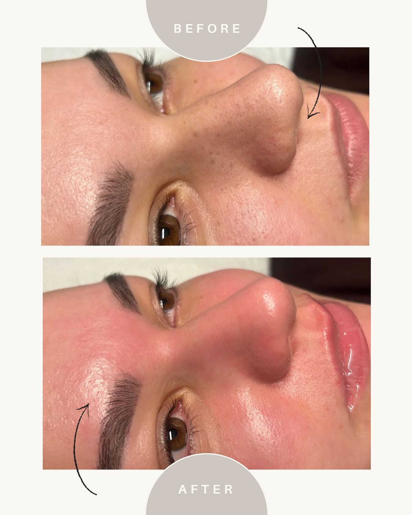 im.skinlab Facebook ad: Le glow de la peau après l’hydraskin