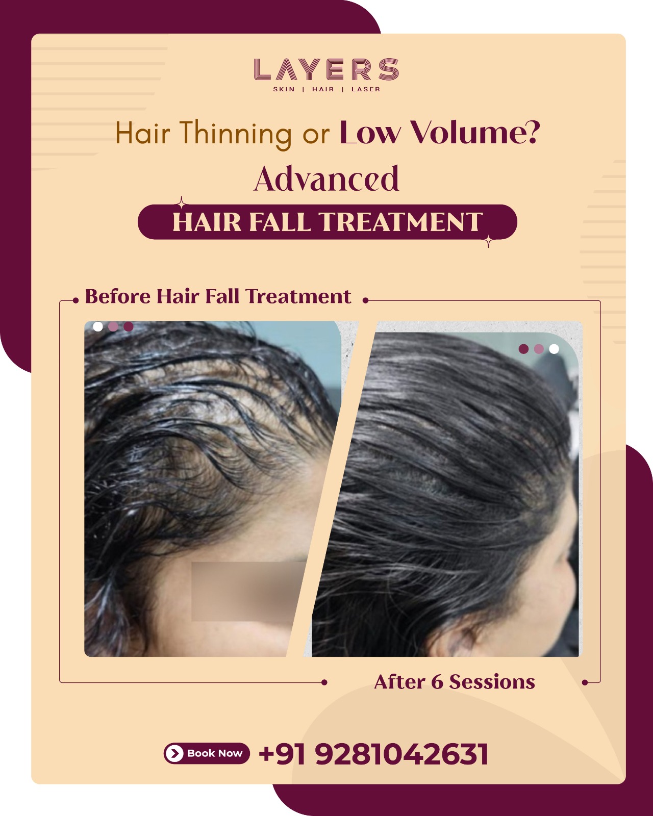 Layers Clinics Facebook ad