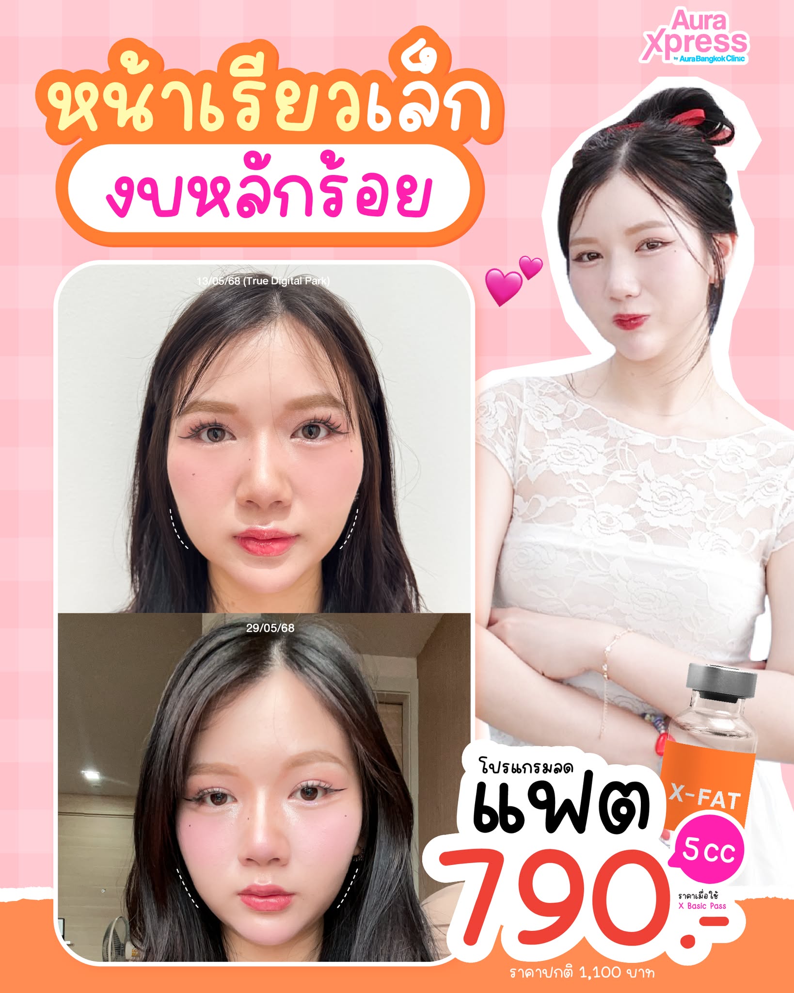 Aura Xpress by Aura Bangkok Clinic Facebook ad