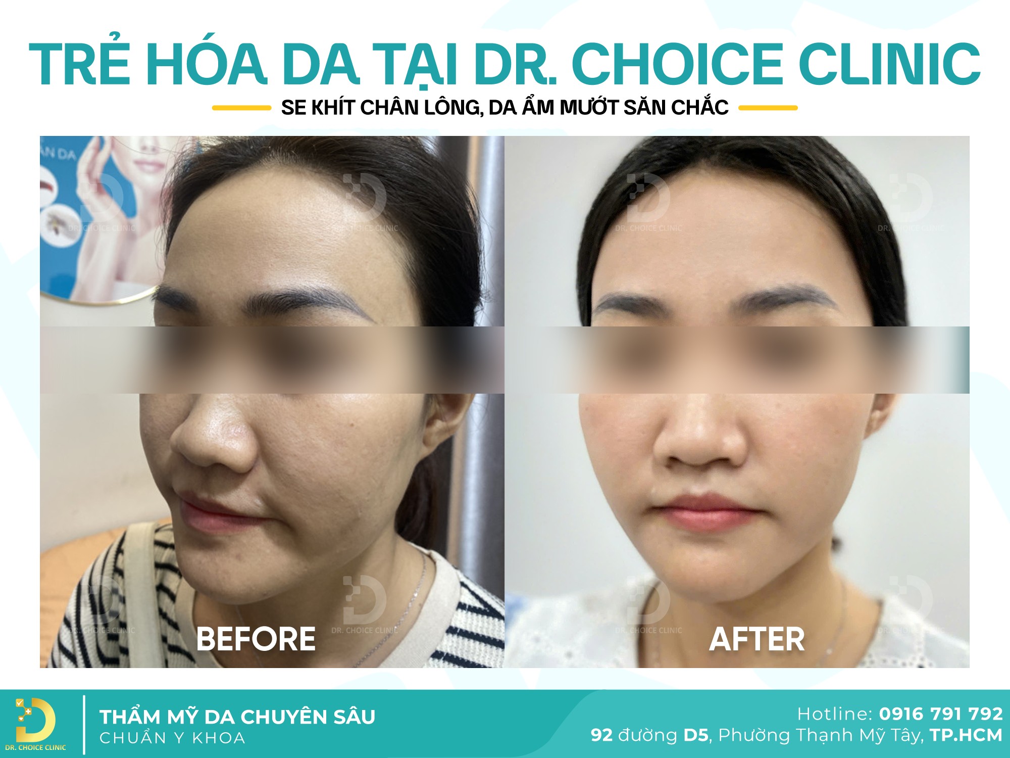 Dr. Choice - Chăm Sóc Da Chuyên Sâu Chuẩn Y Khoa Facebook ad: HACK THERAPY - CHO LÀN DA LỖ CHÂN…