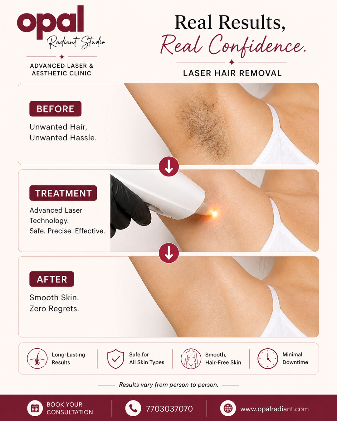 Opalradiant Facebook ad
