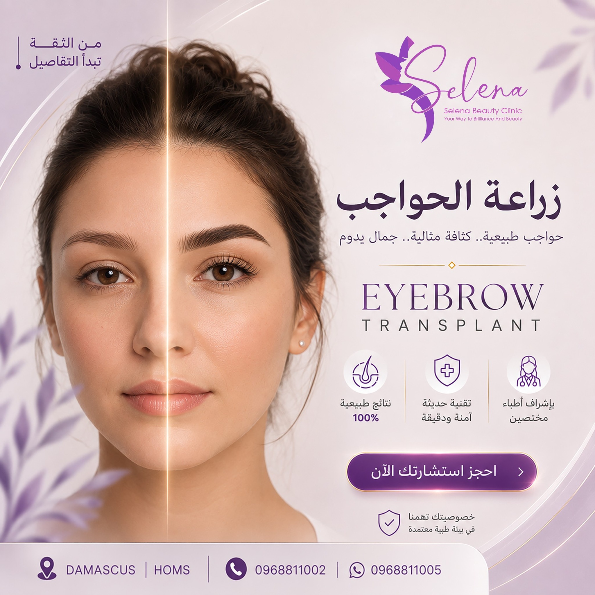 selena beauty clinic Facebook ad: الزراعة