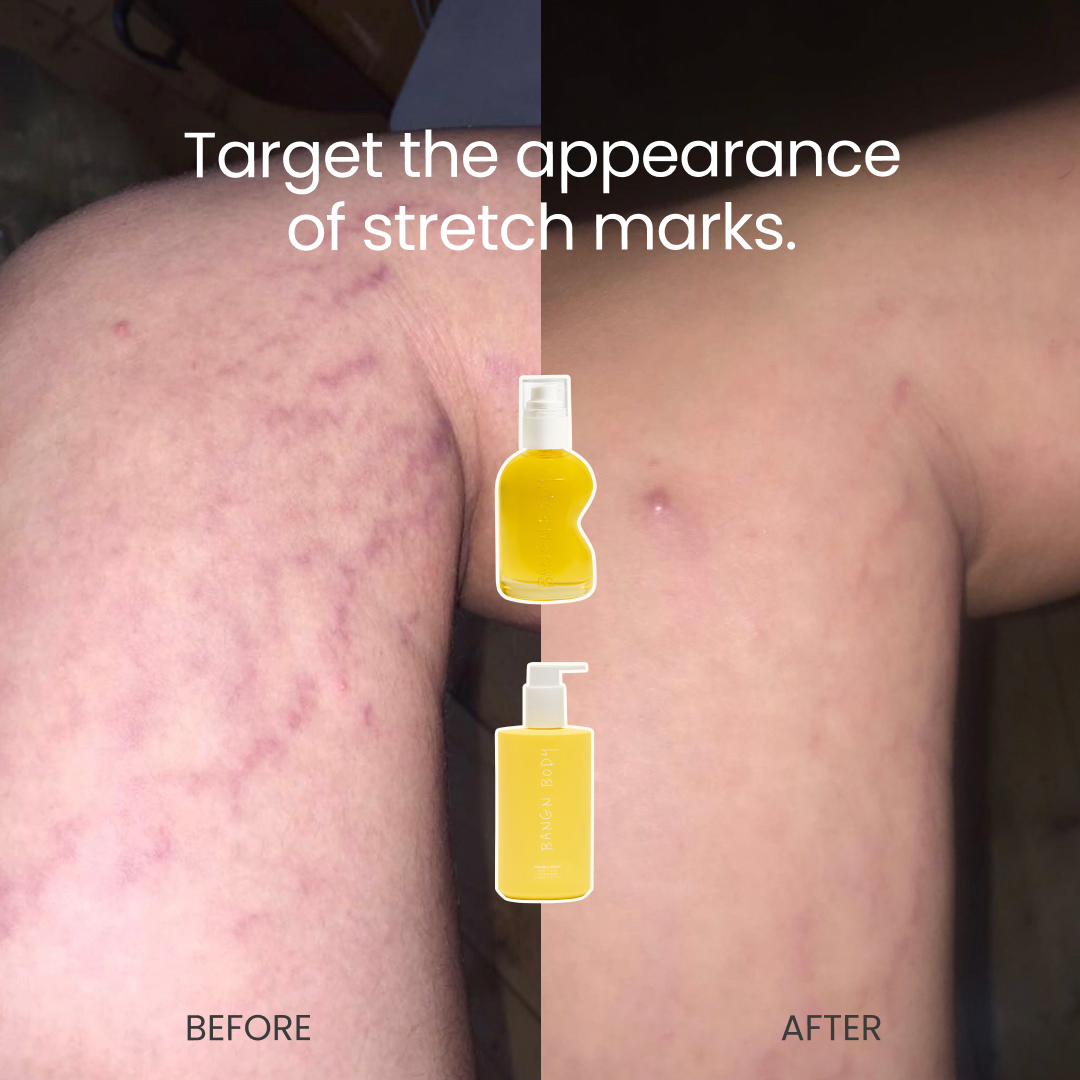 Bangn Body Facebook ad: Real Skin, Real Results