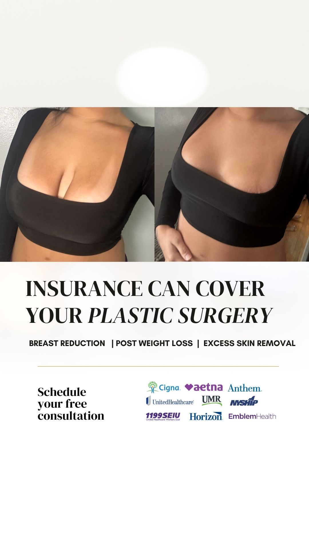 Dr. Itay Wiser MD - Breast Plastic, Cosmetic & Reconstructive Surgeon Facebook ad