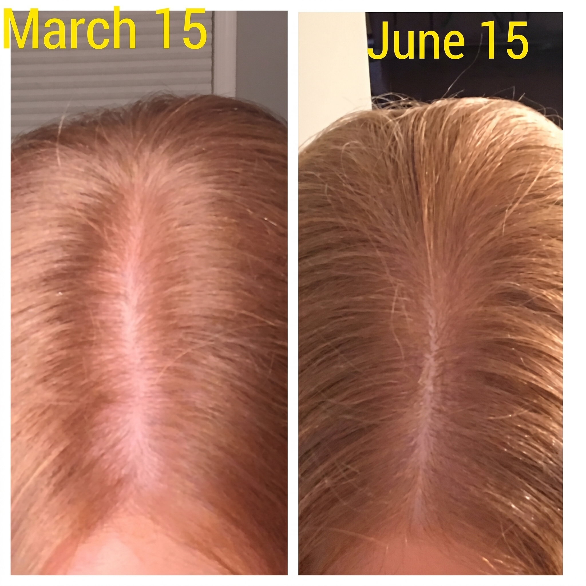 The Honest Root Facebook ad: What am I doing wrong with my postpartum hair loss