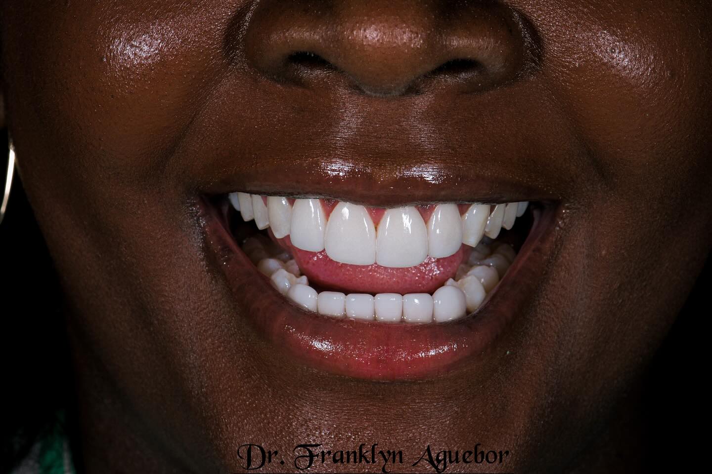 Dr. Franklyn O. Aguebor Facebook ad