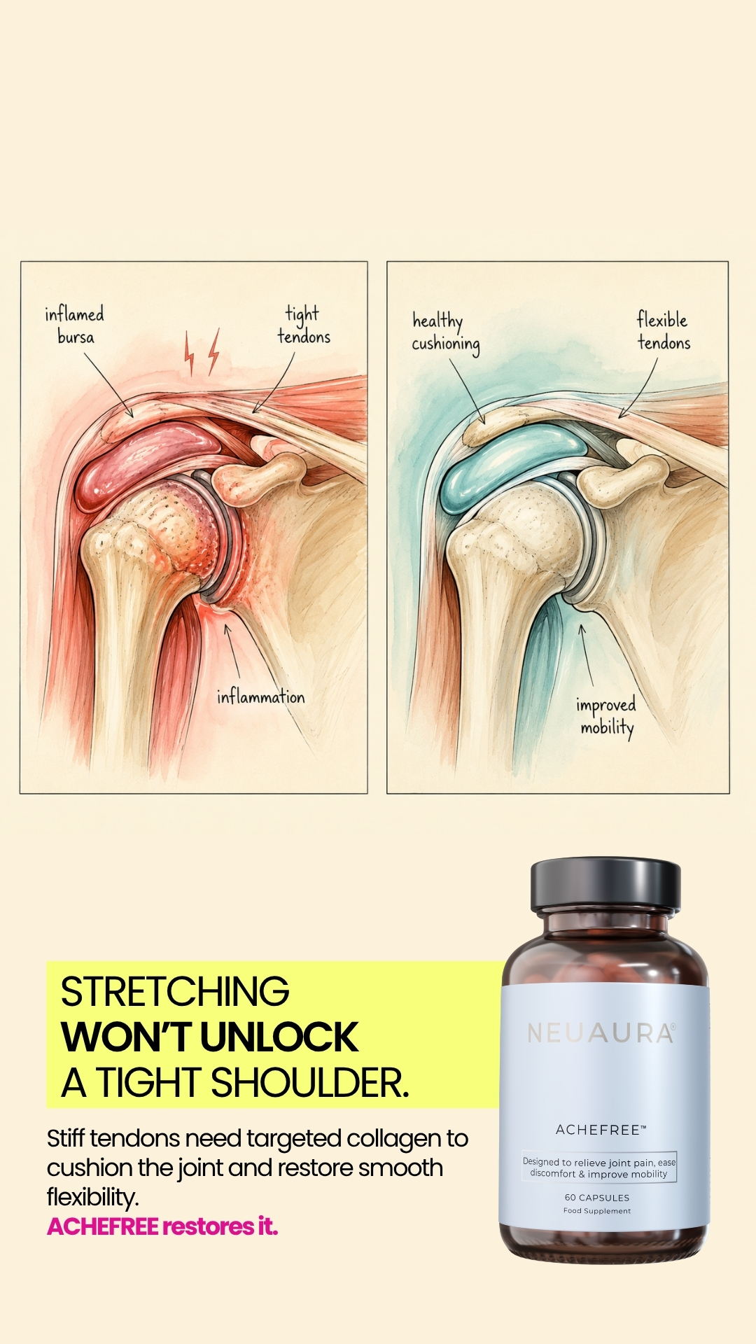Neuaura Facebook ad