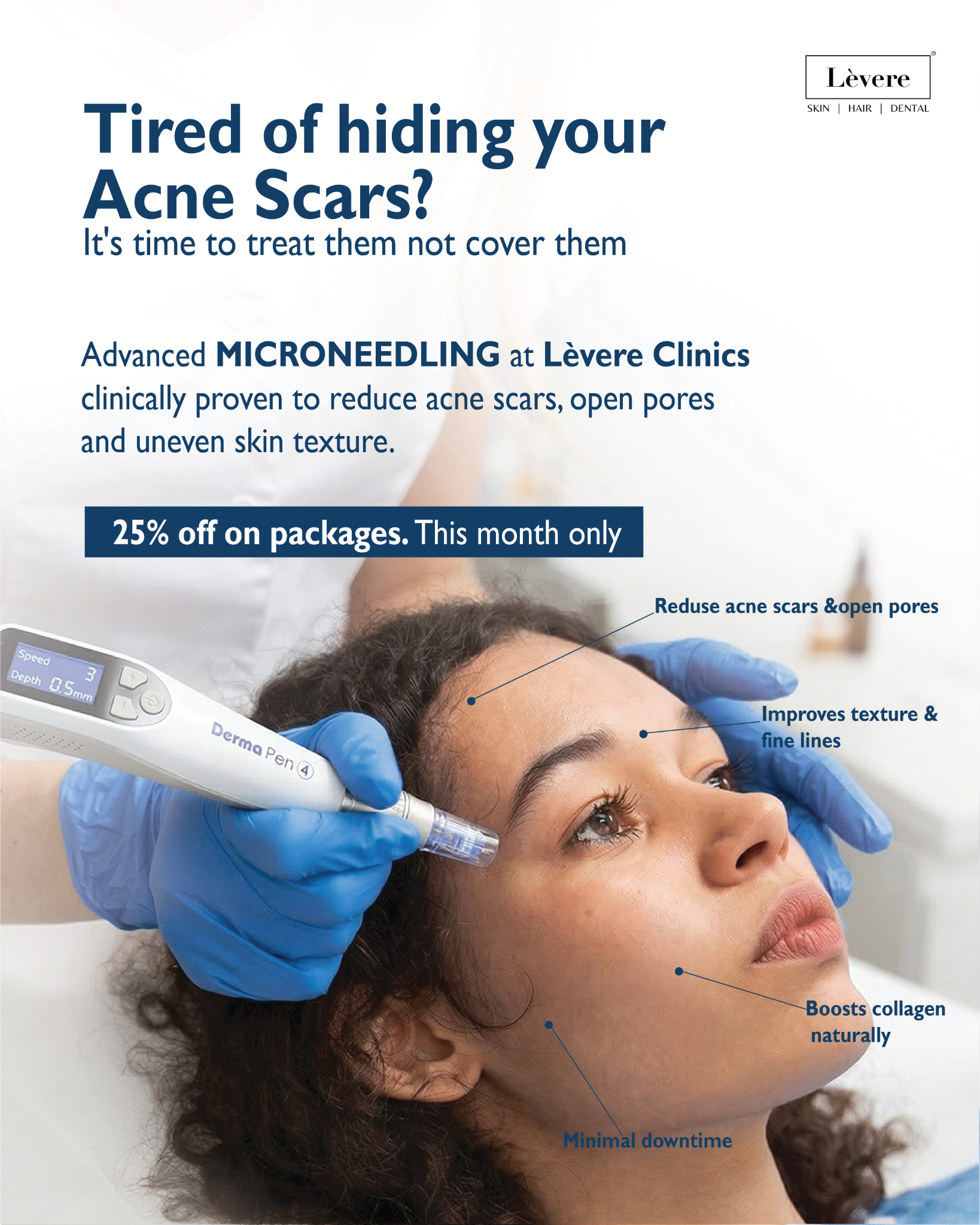 Levere Aesthetic Clinics Facebook ad: Tired of hiding your acne scars?