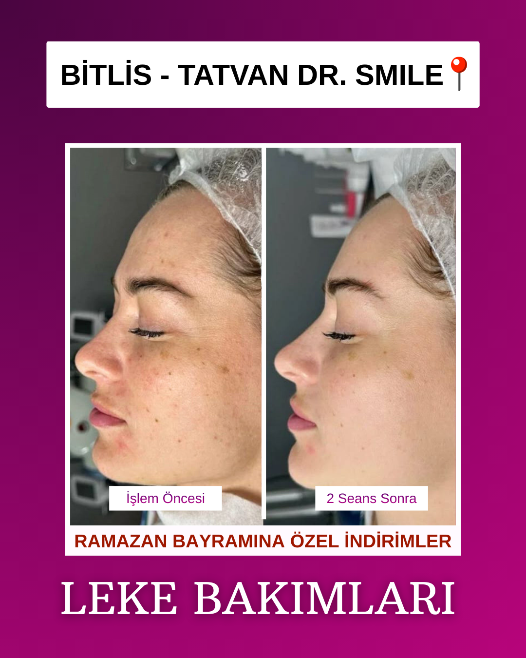 Drsmile.tatvan Facebook ad from Mar 12, 2026