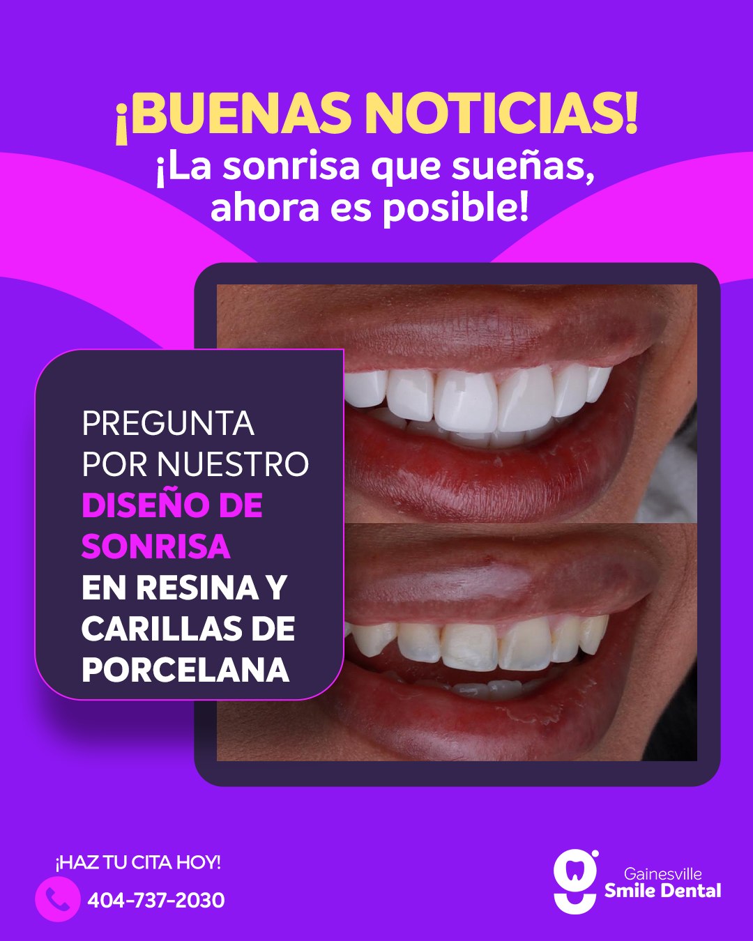Gainesville Smile Dental Facebook ad: ¡BUENAS NOTICIAS!