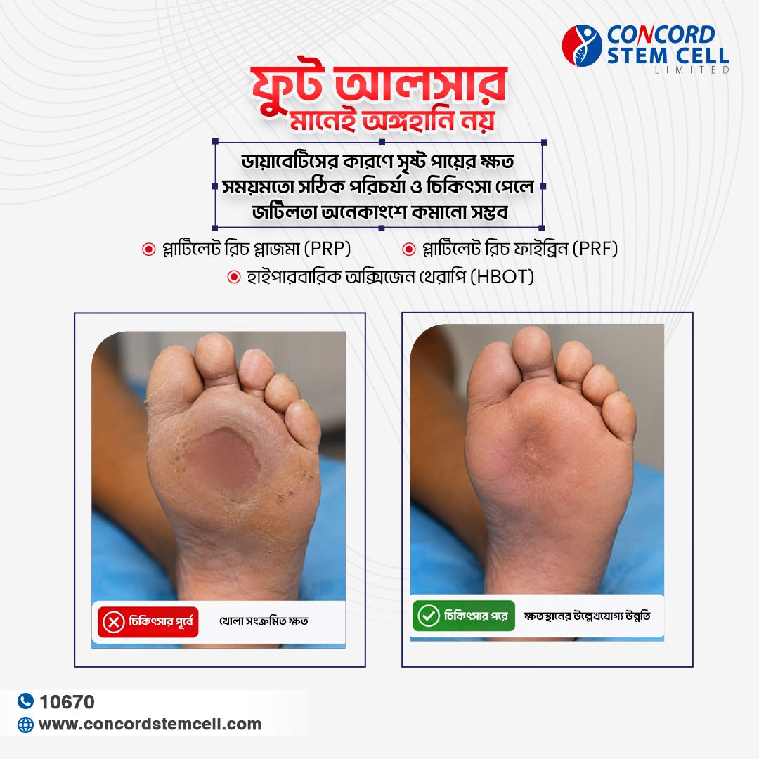 Concord Stem Cell Limited Facebook ad