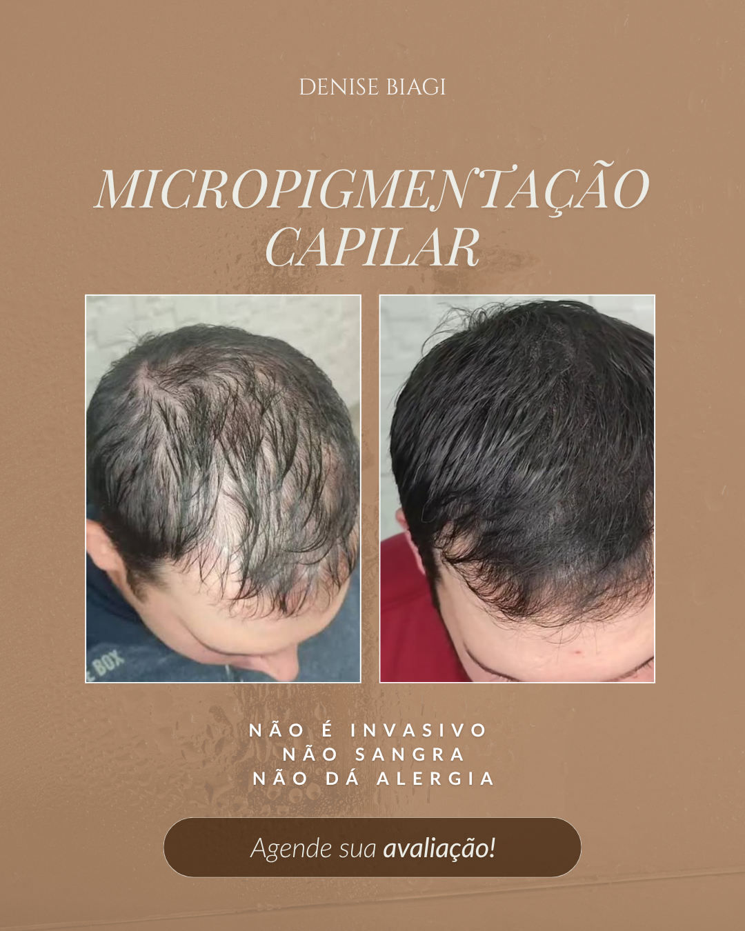 Denise Biagi Dermopigmentadora Facebook ad: Conheça o método!