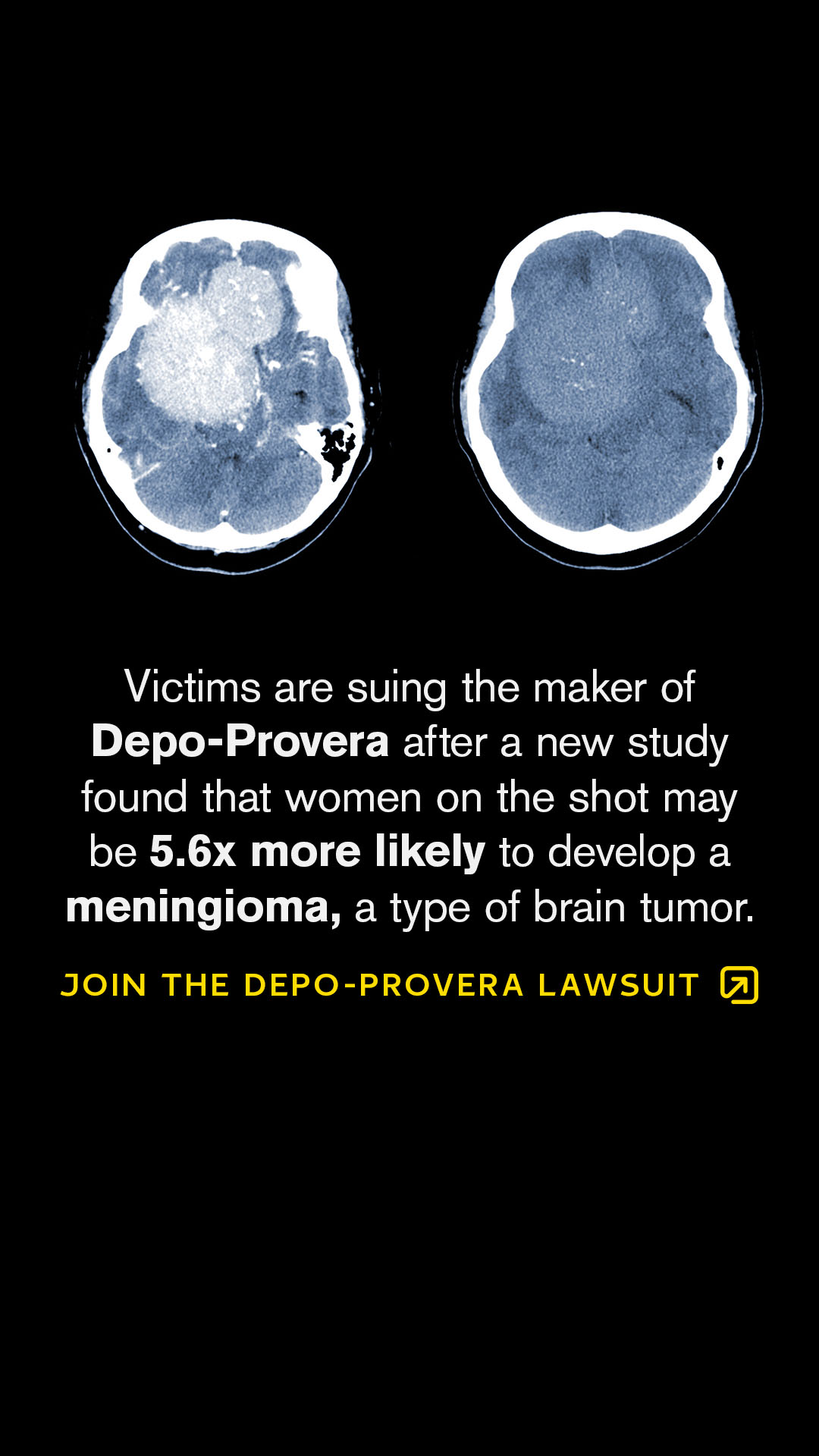 Free Legal Reviews Facebook ad